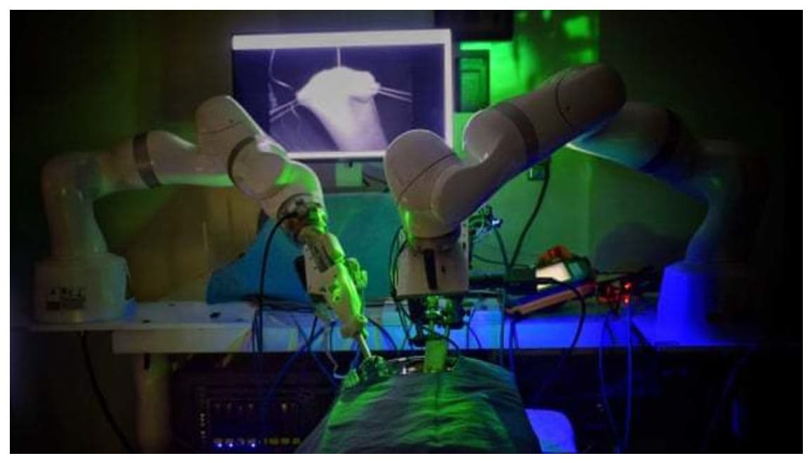 الروبوت ستار ينجح بأول عملياته الجراحية ويهزم معلميه